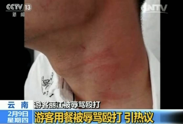 游客麗江就餐被辱罵毆打 真相到底是什么？