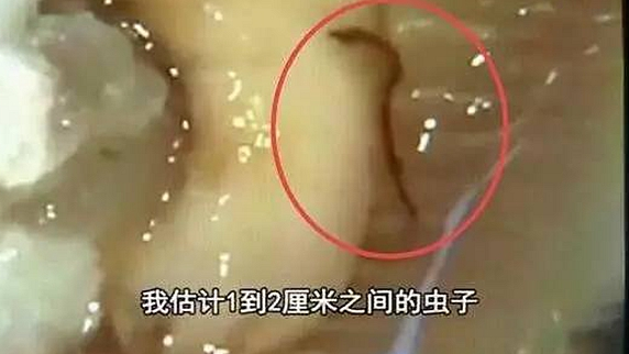 一只生蠔引起的冤案，觸動(dòng)了餐飲人的“麻木神經(jīng)”